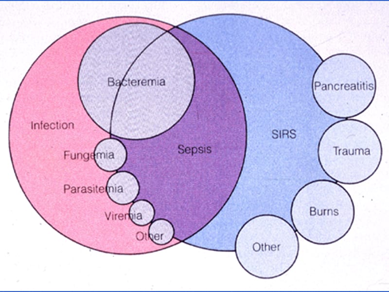 败血症SepticemiaInva.ppt_第3页