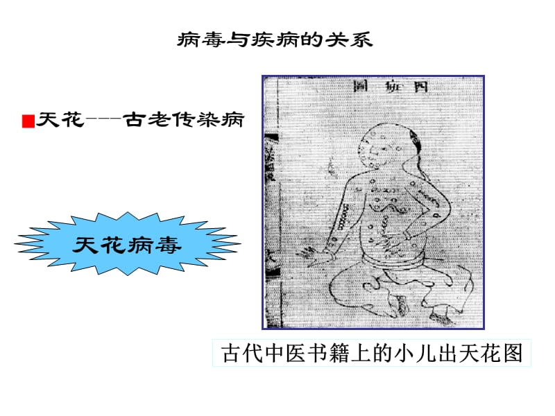 艾滋病的启示.ppt_第2页