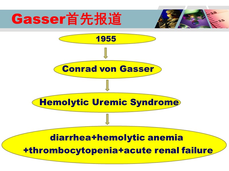 溶血尿毒综合症(he).ppt_第3页