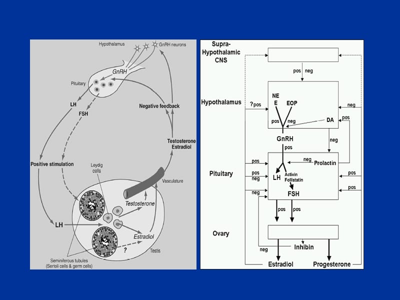 性腺功能减退分类、病因、诊断及治疗.ppt_第3页