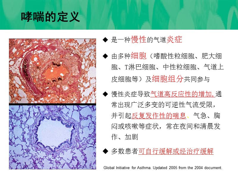 吸入激素健康调查.ppt_第3页