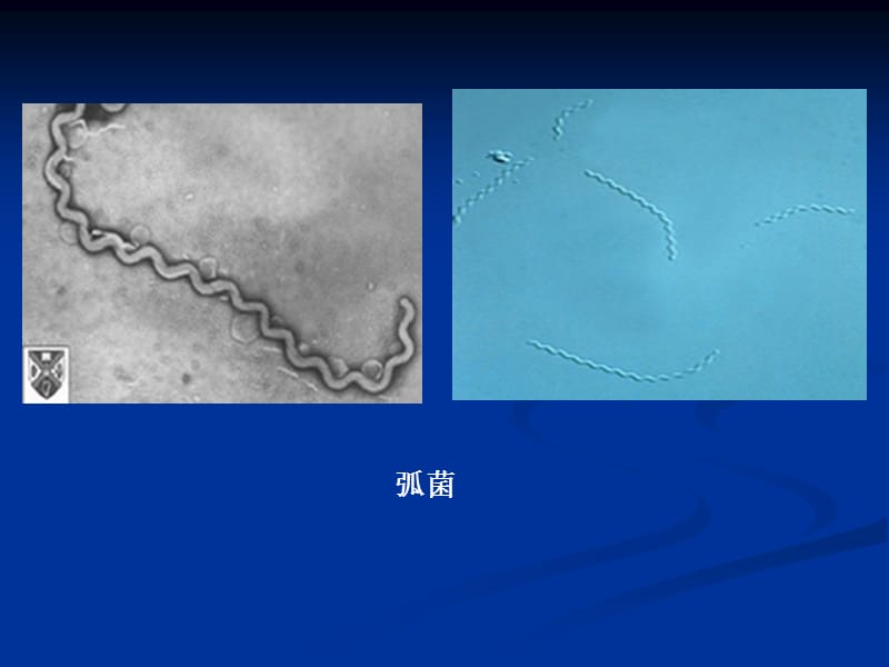 微生物实验二细菌的简单染色和革兰氏染色.ppt_第3页