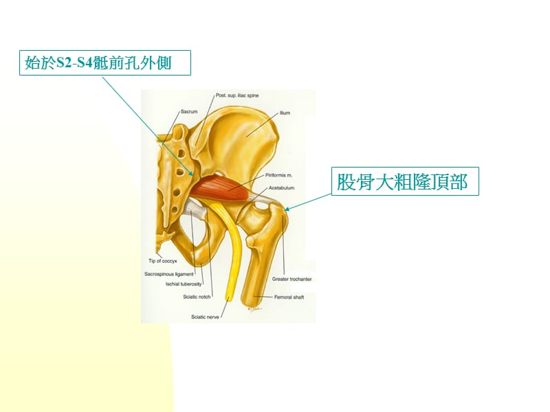 推拿治疗犁状肌综合征.ppt_第3页