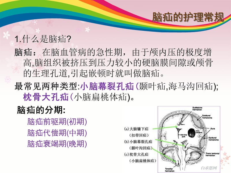 危重病护理常规.ppt_第3页