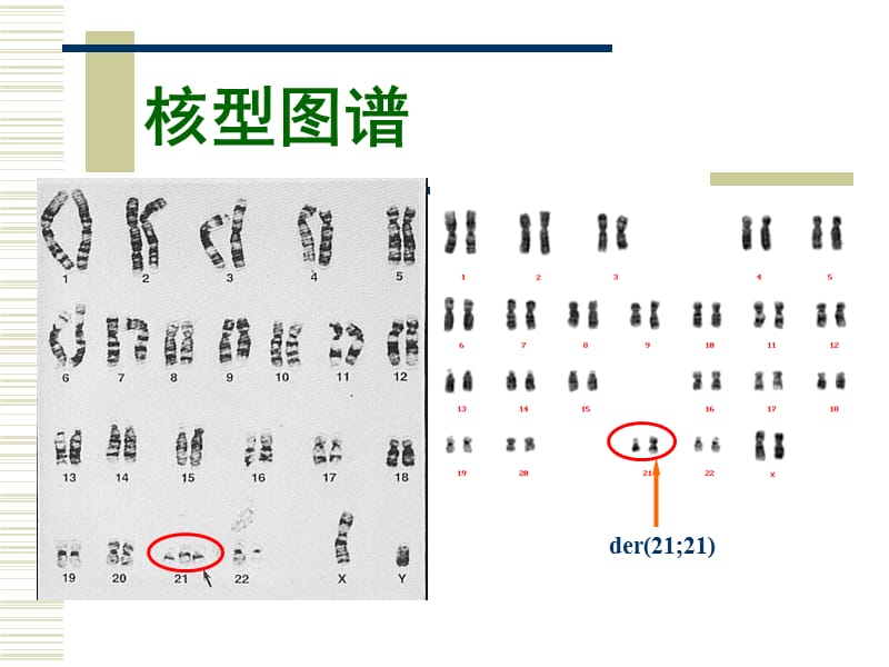 唐氏产前筛查.ppt_第3页