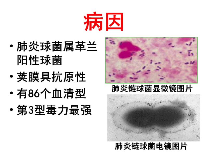 细菌性肺炎.ppt_第3页