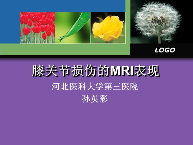 膝关节损伤MRI诊断.ppt_第1页