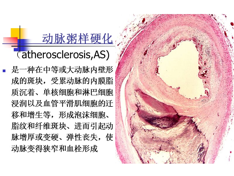 调血脂和抗动脉粥样硬化药物.ppt_第3页