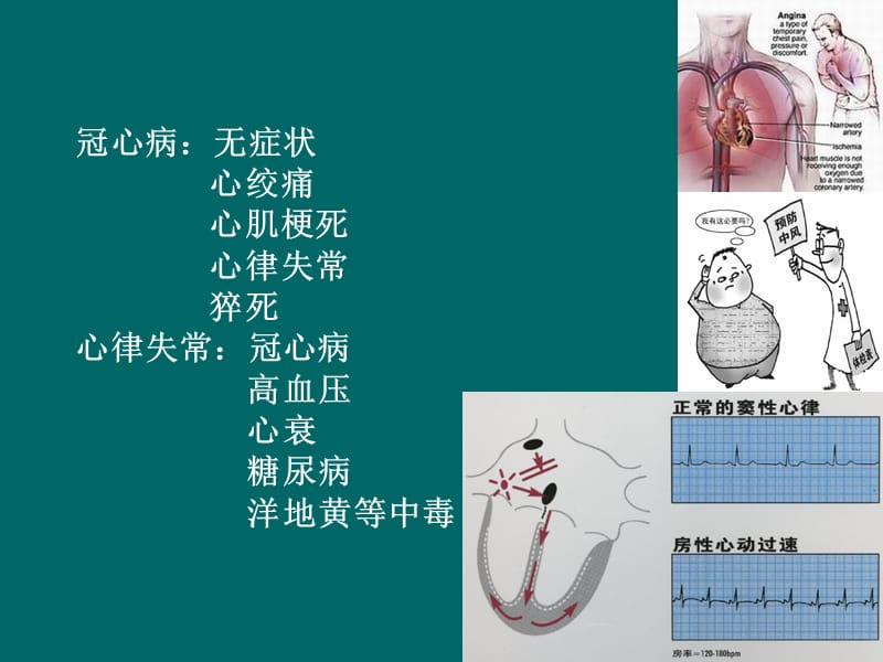 心律失常食疗.ppt_第1页