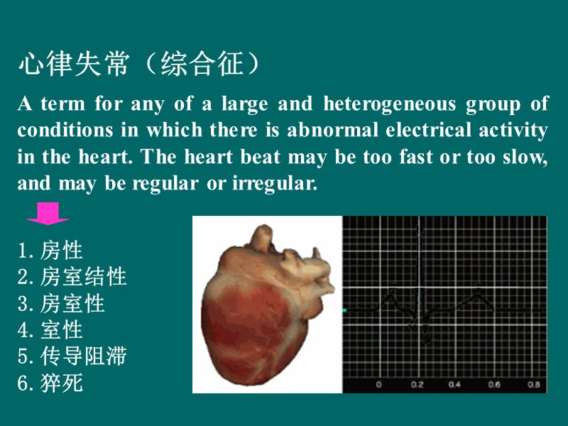 心律失常食疗.ppt_第3页