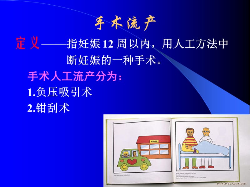 手术流产(12).ppt_第2页