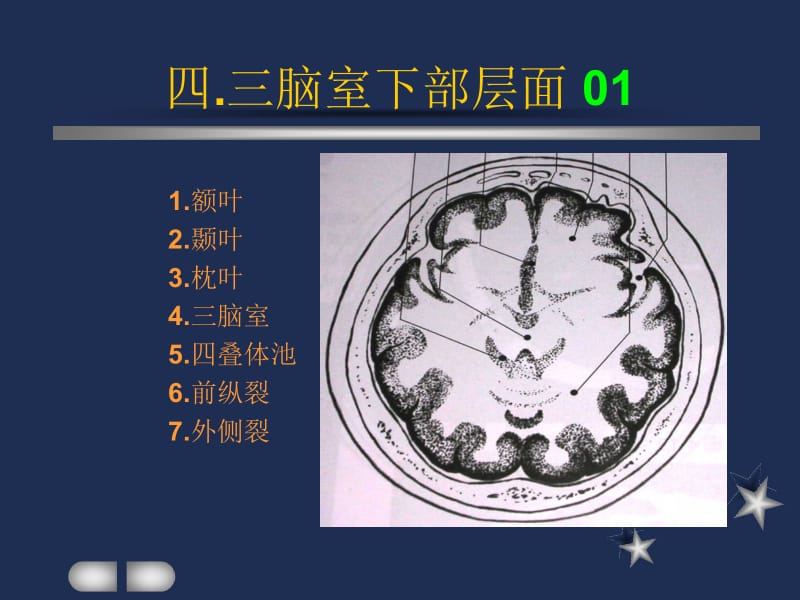 小儿头颅CT图谱3.ppt_第1页