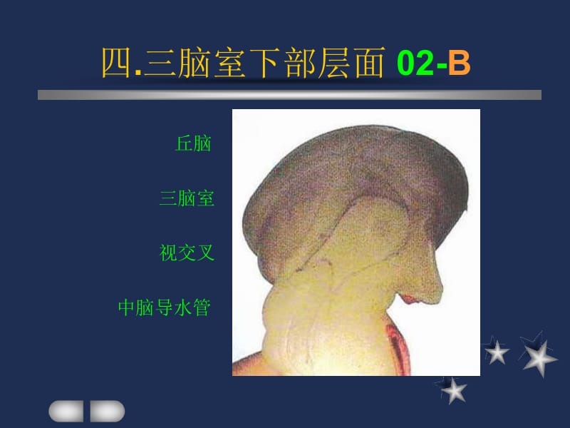 小儿头颅CT图谱3.ppt_第3页