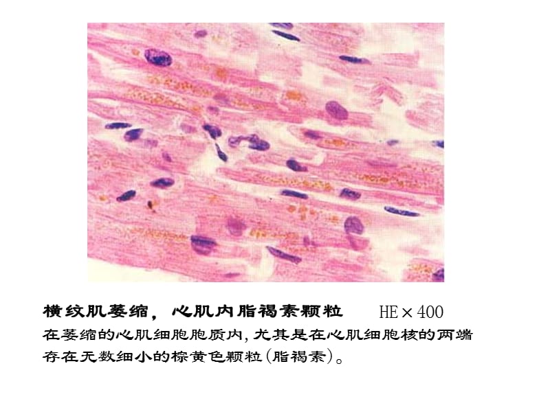 病理切片复习 ppt课件.ppt_第2页