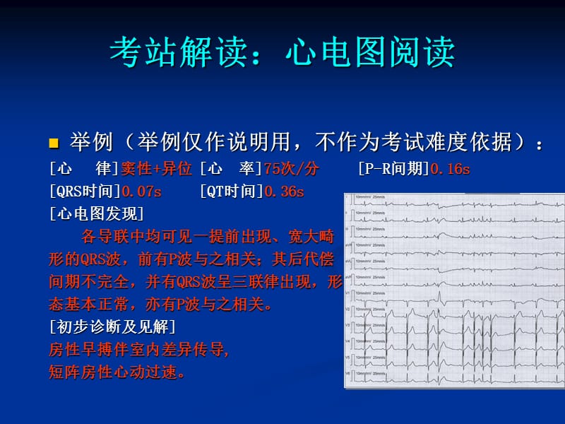 心电图培训实训.ppt_第3页