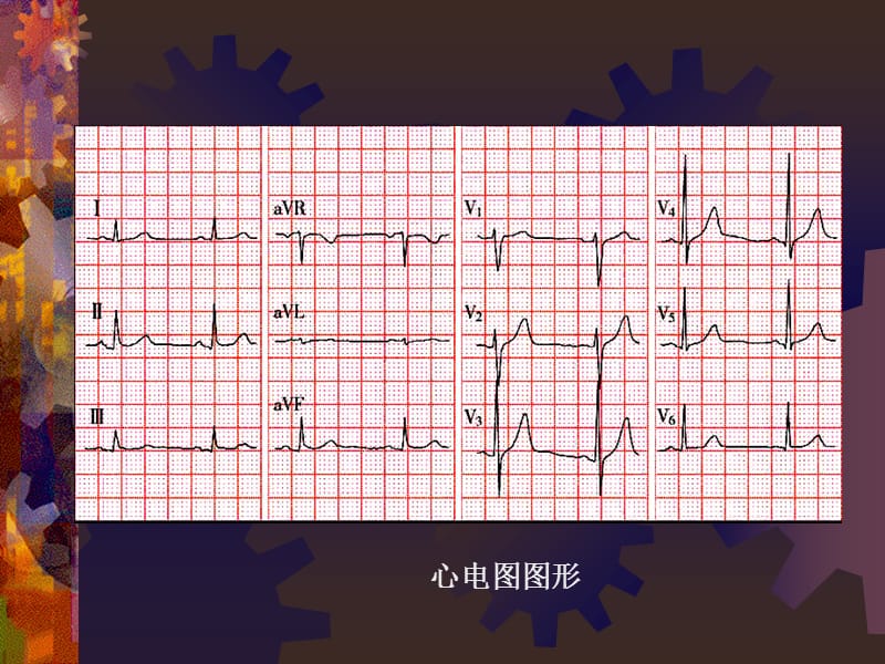 心电图课件1.ppt_第3页