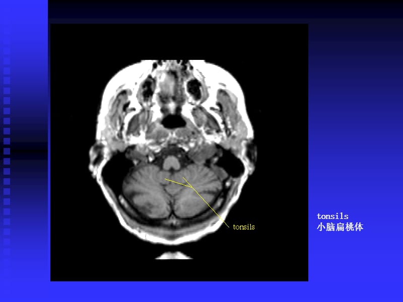 神经学解剖影像.ppt_第2页