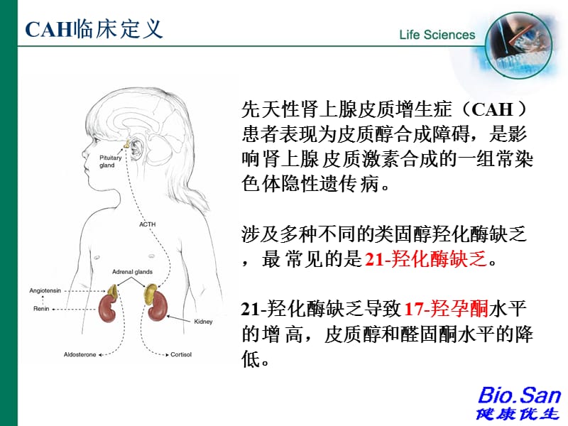 新生儿疾病筛查皮质肾上腺.ppt_第2页