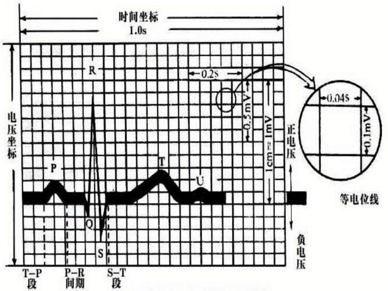 叫你怎样入门看正常心电图_调查报告_表格模板_实用文档.ppt.ppt_第2页