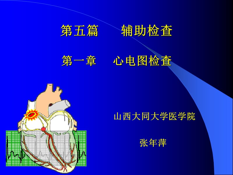 心电图讲义-第五篇 辅助检查第一章 心电图检查.ppt_第1页