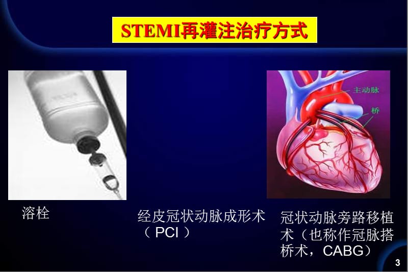 邢台市人民医院魏庆民.ppt_第3页