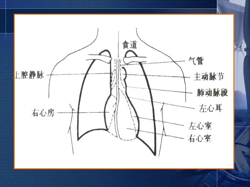 心脏检体诊断.ppt_第3页