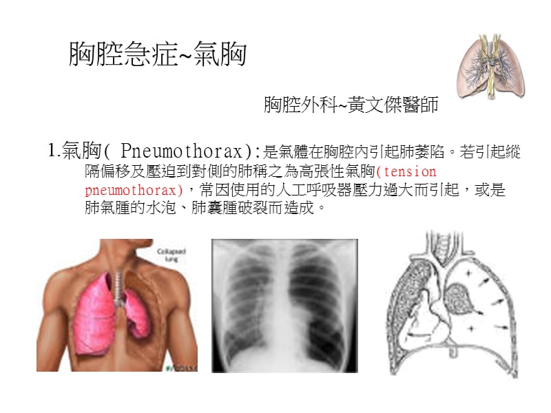 胸腔急症气胸.ppt_第1页