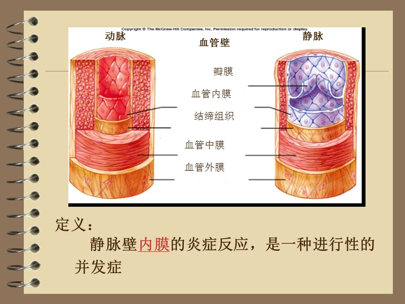 输液性静脉炎的研究进展1.ppt_第2页