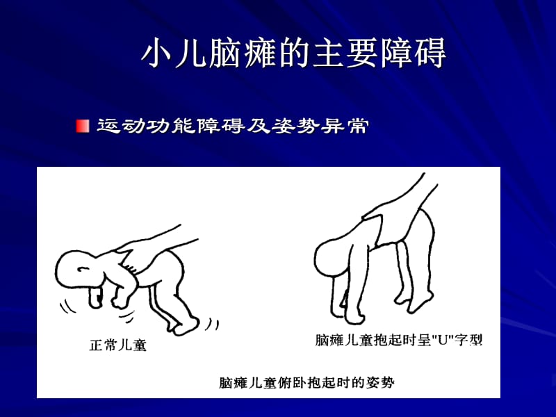 苏州残联培训-脑瘫评估与训练.ppt_第3页