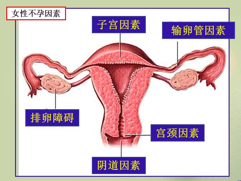 输卵管通液术2015.3.31.ppt_第3页