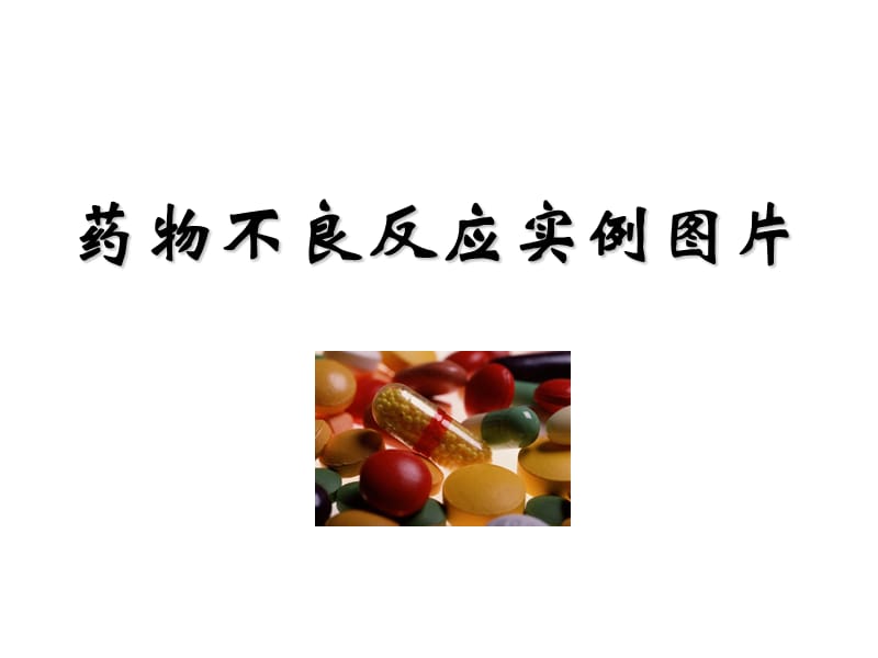 药物不良反应实例图片(研究生)(14).ppt_第1页