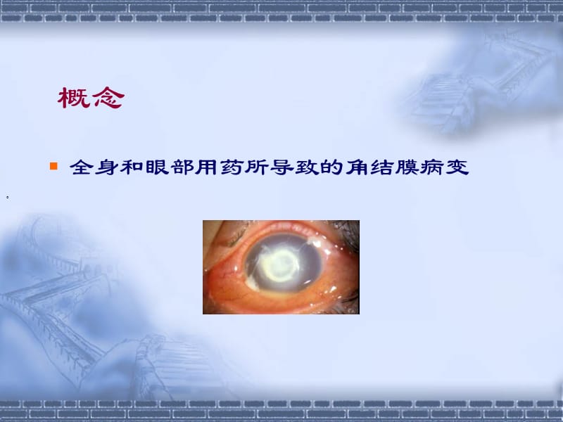 药源性角结膜病变.ppt_第2页