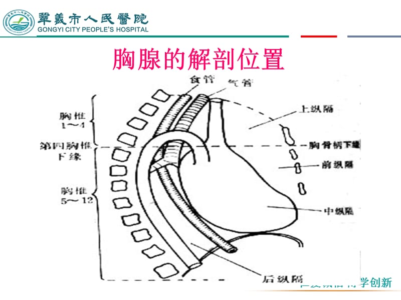 胸腺瘤合并重症肌无力患者的护理.ppt_第3页