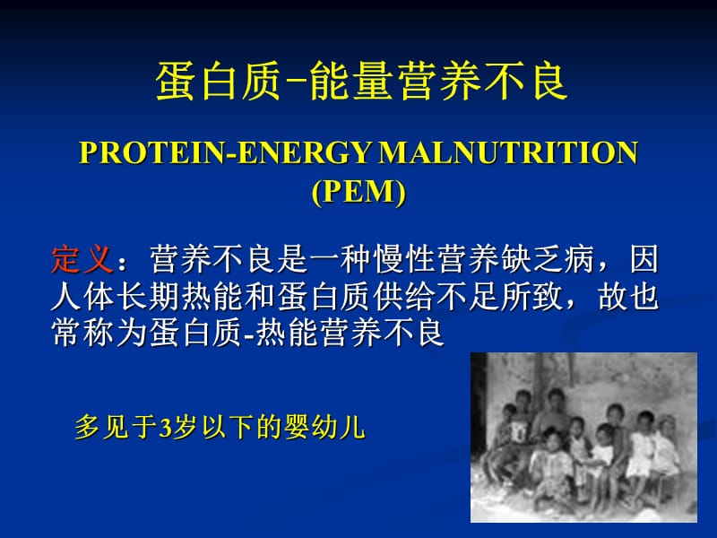 营养缺乏性疾病.ppt_第2页