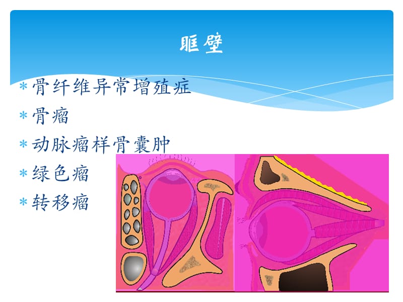 眼部解剖基础与影像学定位诊断 (下).ppt_第2页