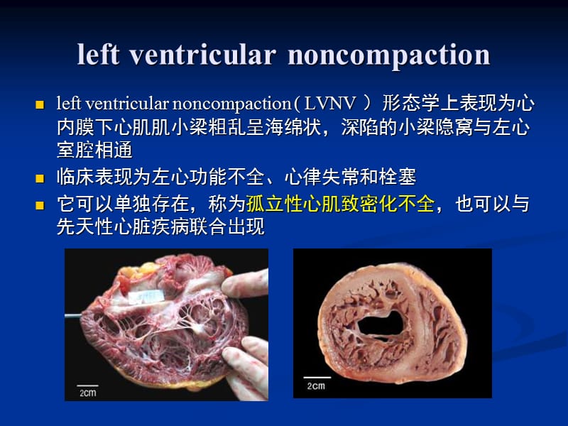 赵世华放射科.ppt_第3页