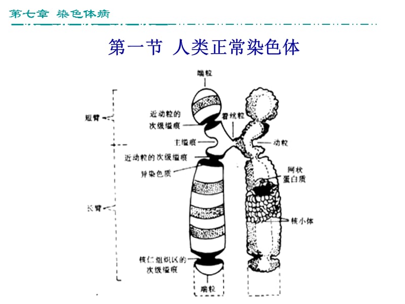 染色体病(11+傅自学版).ppt_第2页