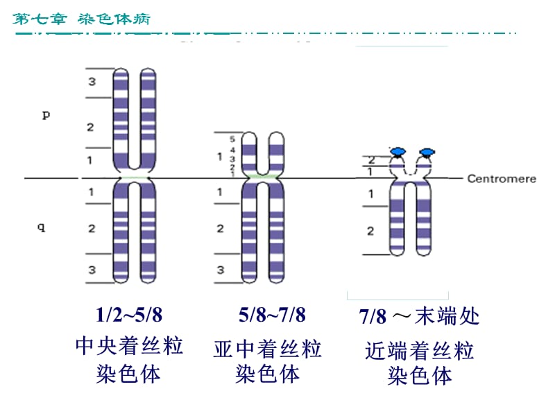 染色体病(11+傅自学版).ppt_第3页