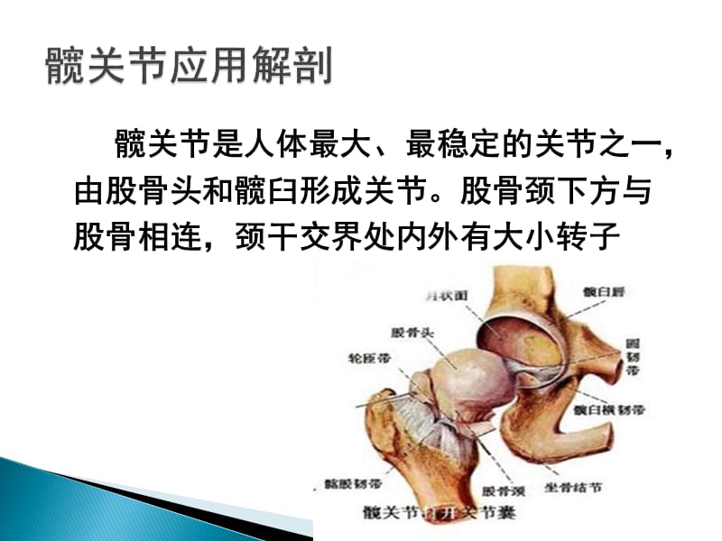 人工全髋关节置换术.ppt_第2页