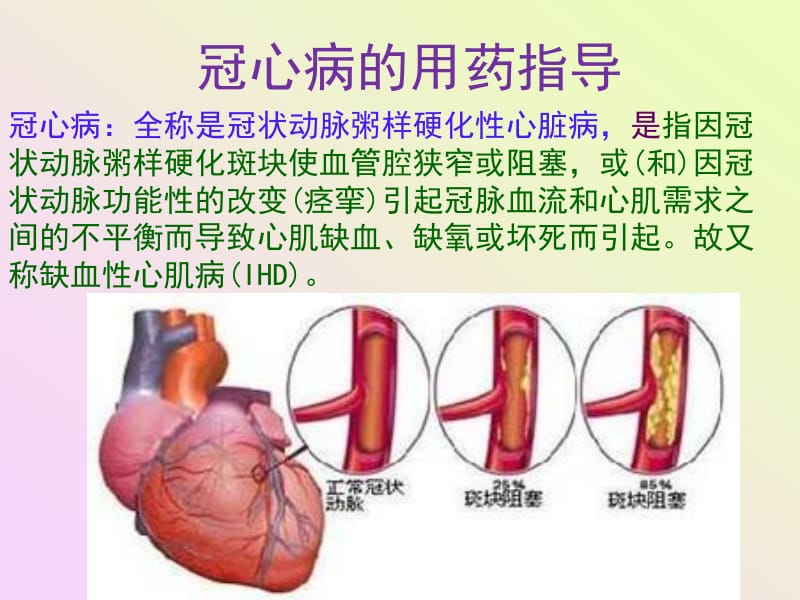 项目十 冠心病的用药指导.ppt_第1页