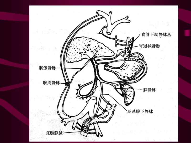 病理学肝硬化(下部分).ppt_第2页