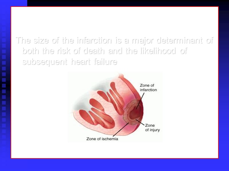 缺血预处理.ppt_第3页