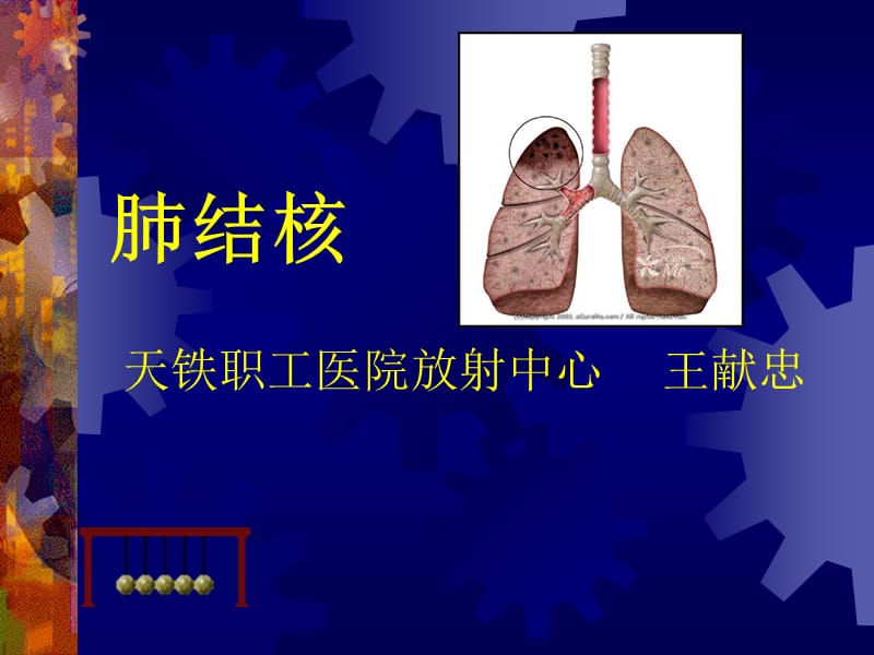 肺结核ppt课件.ppt_第1页