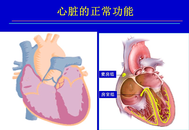 起搏治疗现状—王亚玲.ppt_第3页