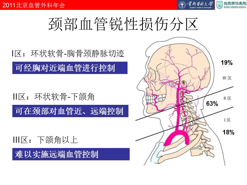 颈肩部大血管损伤的外科处理.ppt_第3页