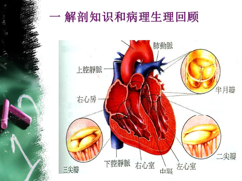 心外科小讲课-风湿性瓣膜病的外科治疗与护理.ppt_第2页