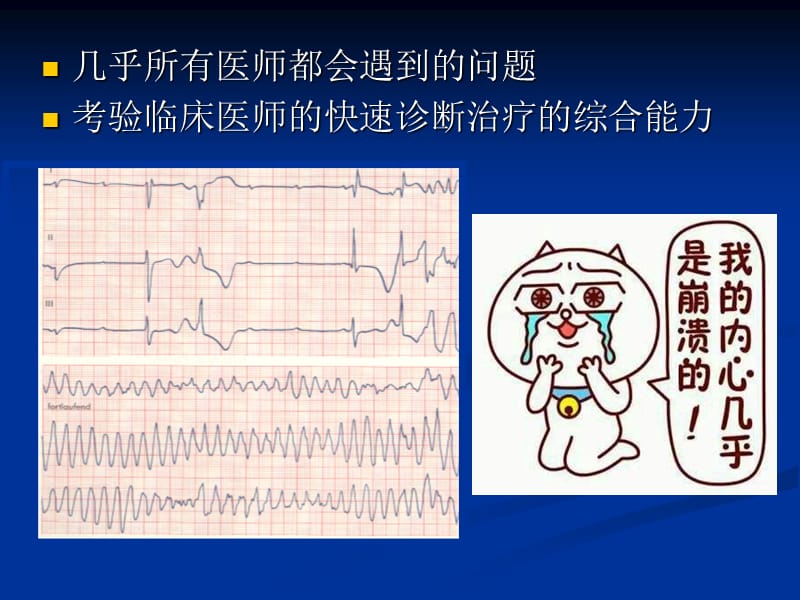 快速性心律失常急诊药物治疗 课件 20170209.ppt_第2页