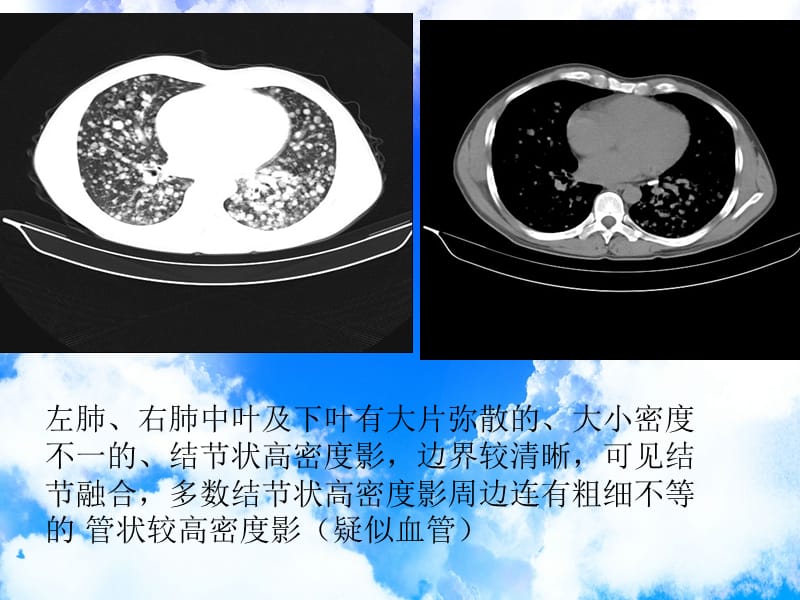 兰大医学影像疾病影像分析.ppt_第2页