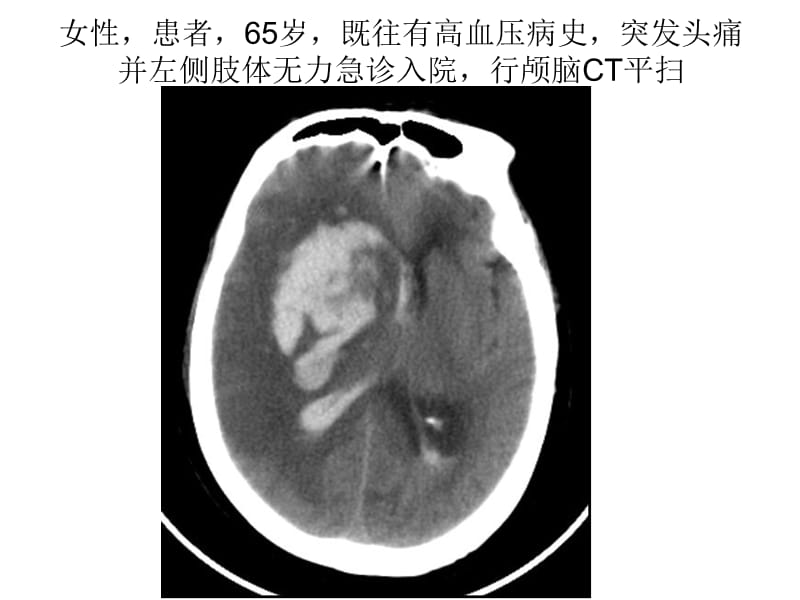 临床医师考试(放射学,答案).ppt_第2页