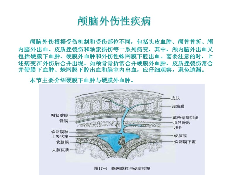 颅脑外伤性疾病.ppt_第1页